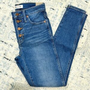 Madewell 10” High-Rise Skinny